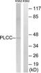 1-Acylglycerol-3-Phosphate O-Acyltransferase 3 antibody, TA315627, Origene, Western Blot image 