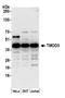 Tropomodulin 3 antibody, A305-456A, Bethyl Labs, Western Blot image 