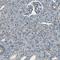 Lysophosphatidylcholine Acyltransferase 1 antibody, HPA012501, Atlas Antibodies, Immunohistochemistry frozen image 