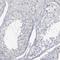 Arginine-Fifty Homeobox antibody, NBP2-14307, Novus Biologicals, Immunohistochemistry frozen image 