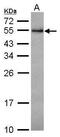 RCC1 And BTB Domain Containing Protein 1 antibody, PA5-30672, Invitrogen Antibodies, Western Blot image 