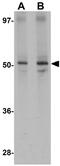 Jumonji Domain Containing 6, Arginine Demethylase And Lysine Hydroxylase antibody, GTX31387, GeneTex, Western Blot image 
