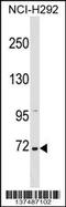 Zinc Finger Protein 571 antibody, 59-222, ProSci, Western Blot image 
