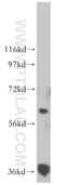 Retinol Dehydrogenase 14 antibody, 16283-1-AP, Proteintech Group, Western Blot image 