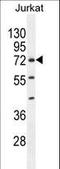 Zinc Finger Protein 648 antibody, LS-C160926, Lifespan Biosciences, Western Blot image 