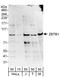 Zinc Finger And BTB Domain Containing 1 antibody, A303-242A, Bethyl Labs, Western Blot image 