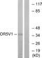 Olfactory Receptor Family 5 Subfamily V Member 1 antibody, A16114, Boster Biological Technology, Western Blot image 