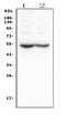 Dopamine Receptor D5 antibody, PA2204, Boster Biological Technology, Western Blot image 
