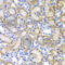 HAP antibody, A1603, ABclonal Technology, Immunohistochemistry paraffin image 