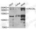DNA excision repair protein ERCC-6-like antibody, A6139, ABclonal Technology, Western Blot image 