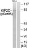 Kinesin-like protein KIF2C antibody, LS-C199168, Lifespan Biosciences, Western Blot image 