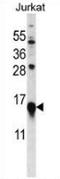Myosin RLC antibody, AP52791PU-N, Origene, Western Blot image 