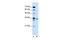 Solute Carrier Family 25 Member 32 antibody, GTX46789, GeneTex, Western Blot image 