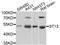 ST13 Hsp70 Interacting Protein antibody, orb374140, Biorbyt, Western Blot image 