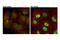 Signal Transducer And Activator Of Transcription 1 antibody, 14994S, Cell Signaling Technology, Immunocytochemistry image 