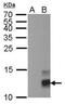 Pancreatic polypeptide antibody, NBP2-43664, Novus Biologicals, Western Blot image 