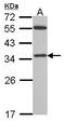 Voltage Dependent Anion Channel 2 antibody, PA5-28106, Invitrogen Antibodies, Western Blot image 