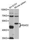 Radical S-Adenosyl Methionine Domain Containing 2 antibody, A02927-1, Boster Biological Technology, Western Blot image 