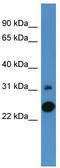 Carbonic Anhydrase 7 antibody, TA342843, Origene, Western Blot image 