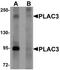 Pappalysin-2 antibody, orb94593, Biorbyt, Western Blot image 