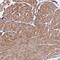 Bone Marrow Stromal Cell Antigen 1 antibody, NBP2-14363, Novus Biologicals, Immunohistochemistry paraffin image 
