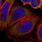 STOM antibody, HPA010961, Atlas Antibodies, Immunofluorescence image 