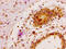 MAP3K6 antibody, LS-C673021, Lifespan Biosciences, Immunohistochemistry paraffin image 