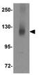 Class II Major Histocompatibility Complex Transactivator antibody, GTX31419, GeneTex, Western Blot image 