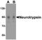 Neurotrypsin antibody, A10045, Boster Biological Technology, Western Blot image 
