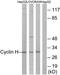 Cyclin H antibody, TA313183, Origene, Western Blot image 