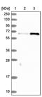 CTD Small Phosphatase Like 2 antibody, PA5-59287, Invitrogen Antibodies, Western Blot image 