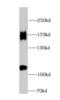 Histone Deacetylase 6 antibody, FNab03804, FineTest, Western Blot image 