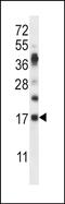 Ribonuclease A Family Member K6 antibody, PA5-71818, Invitrogen Antibodies, Western Blot image 