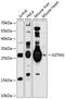 Glutathione S-Transferase Mu 1 antibody, 23-734, ProSci, Western Blot image 