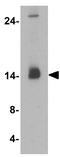 Microtubule Associated Protein 1 Light Chain 3 Beta antibody, GTX31899, GeneTex, Western Blot image 