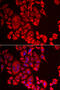 Glutaminyl-Peptide Cyclotransferase antibody, abx005148, Abbexa, Western Blot image 