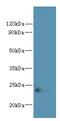 Family With Sequence Similarity 156 Member B antibody, A59038-100, Epigentek, Western Blot image 