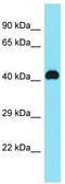 Chromosome 8 Open Reading Frame 76 antibody, TA333596, Origene, Western Blot image 