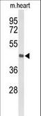 Deleted in bladder cancer protein 1 homolog antibody, LS-C167276, Lifespan Biosciences, Western Blot image 