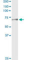 Biotinidase antibody, LS-C196774, Lifespan Biosciences, Immunoprecipitation image 