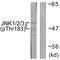 Mitogen-Activated Protein Kinase 8 antibody, TA312593, Origene, Western Blot image 