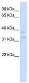 Potassium Channel Regulator antibody, TA341722, Origene, Western Blot image 