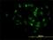 M-Phase Phosphoprotein 10 antibody, H00010199-M02, Novus Biologicals, Immunofluorescence image 