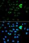 p21 antibody, LS-C746978, Lifespan Biosciences, Immunofluorescence image 