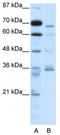 Proprotein Convertase Subtilisin/Kexin Type 6 antibody, TA329886, Origene, Western Blot image 