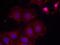 ERBB2 antibody, NB100-81961, Novus Biologicals, Immunocytochemistry image 