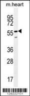 Smoothelin Like 2 antibody, 56-009, ProSci, Western Blot image 