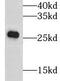 Glutathione S-transferase kappa 1 antibody, FNab03691, FineTest, Western Blot image 