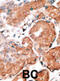 Guanylyl cyclase-activating protein 1 antibody, abx028514, Abbexa, Immunohistochemistry paraffin image 