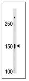 ABL Proto-Oncogene 2, Non-Receptor Tyrosine Kinase antibody, AP12555PU-N, Origene, Western Blot image 